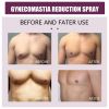 Cellulite Melting Spray Weight Loss Spray 30 ML Breast Firming Gynecomastia Reduction Spray For Men Women Body Care